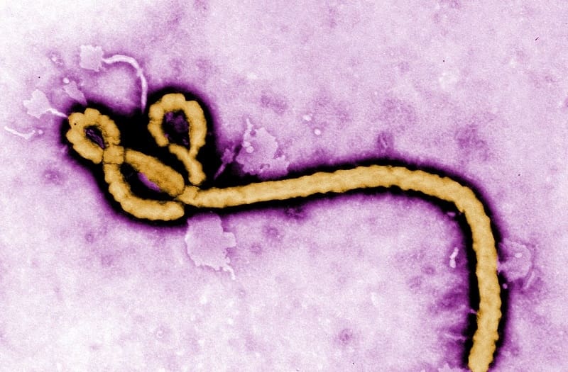 Ebola virus - Deadliest Viruses