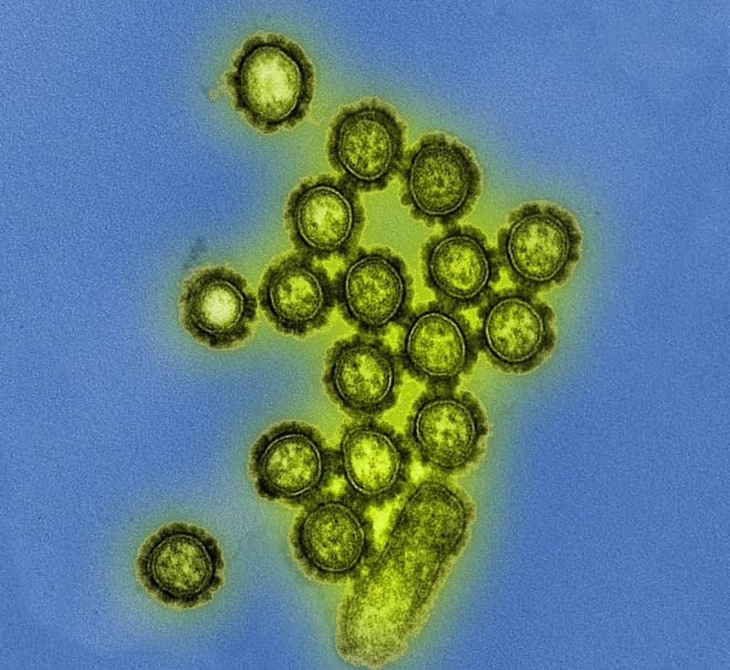 Influenza - Deadliest Viruses