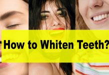 How to whiten teeth Role of a teeth whitening Dentist - teeth whitening at dentist